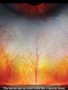 The human eye (sclera) close looks like a spooky forest 